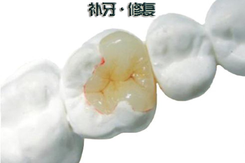 抚州拔牙：守护牙齿健康的必经之路